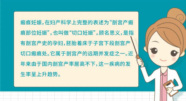 懷孕13周發(fā)現(xiàn)瘢痕妊娠！安琪兒婦科團隊為她拆除身體里的這顆“定時炸彈”