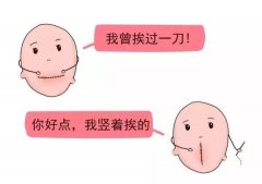 安琪兒孕育精品課|一胎剖了，二胎想順產(chǎn)，來聽