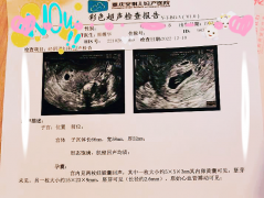 7年求子苦終迎一朝甜，她來安琪兒試管助孕1次就懷上了